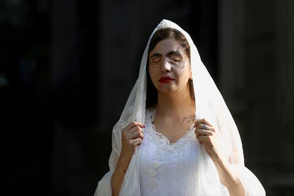 Acid attack victims model for Iranian fashion designer
