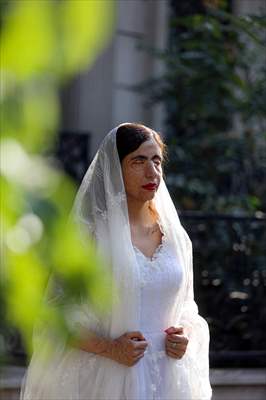 Acid attack victims model for Iranian fashion designer