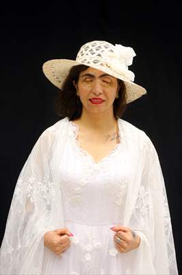 Acid attack victims model for Iranian fashion designer