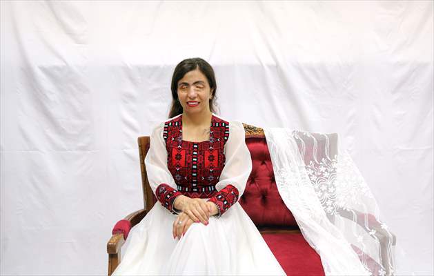 Acid attack victims model for Iranian fashion designer
