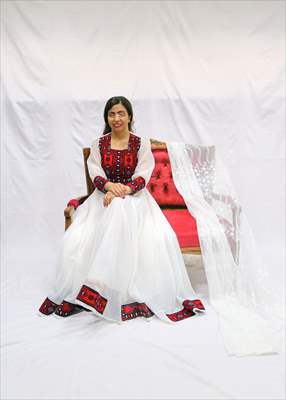 Acid attack victims model for Iranian fashion designer