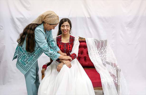 Acid attack victims model for Iranian fashion designer