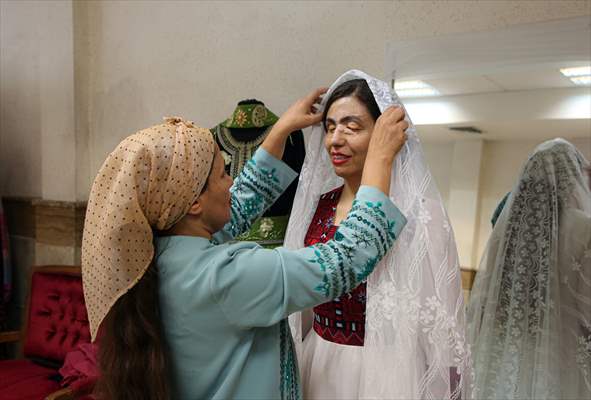 Acid attack victims model for Iranian fashion designer