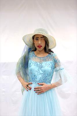 Acid attack victims model for Iranian fashion designer