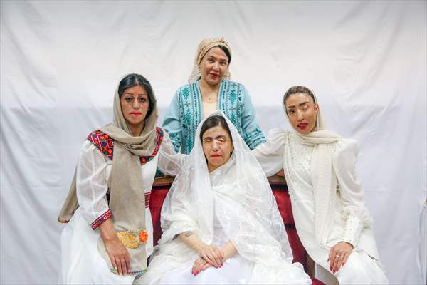 Acid attack victims model for Iranian fashion designer