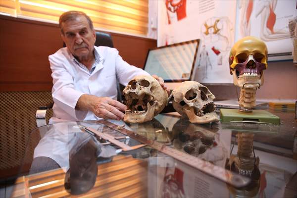Körtik Tepe'den çıkarılan Orta Çağ dönemine ait kemikler cerrahi çalışmalara ışık tutacak