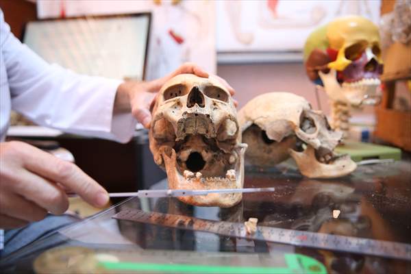 Körtik Tepe'den çıkarılan Orta Çağ dönemine ait kemikler cerrahi çalışmalara ışık tutacak