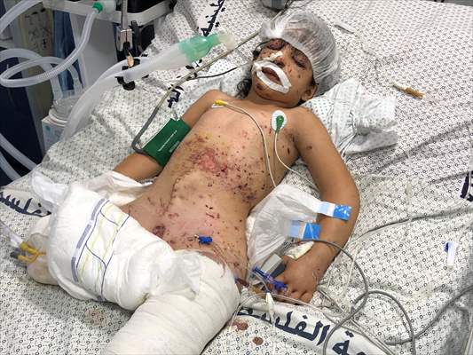 Palestinian girl struggles to survive all alone
