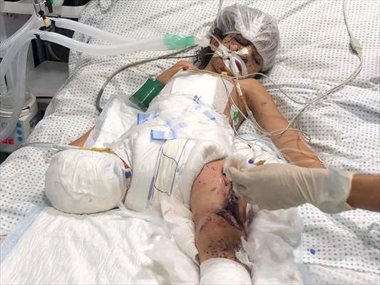 Palestinian girl struggles to survive all alone
