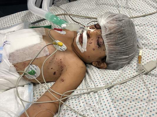 Palestinian girl struggles to survive all alone