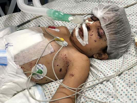 Palestinian girl struggles to survive all alone