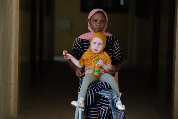 Albino children in Zanzibar