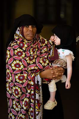 Albino children in Zanzibar