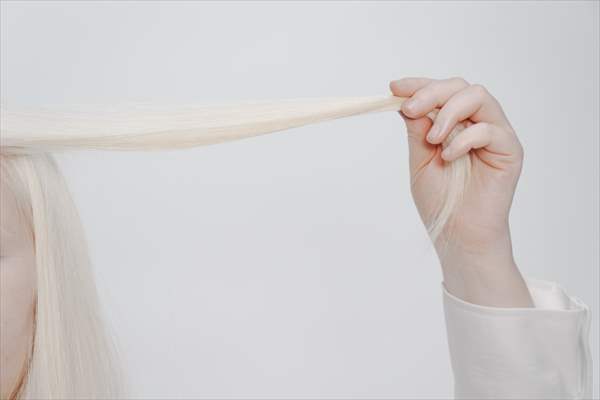 Dünya Nadir Hastalıklar Günü: 'Albino olmak'