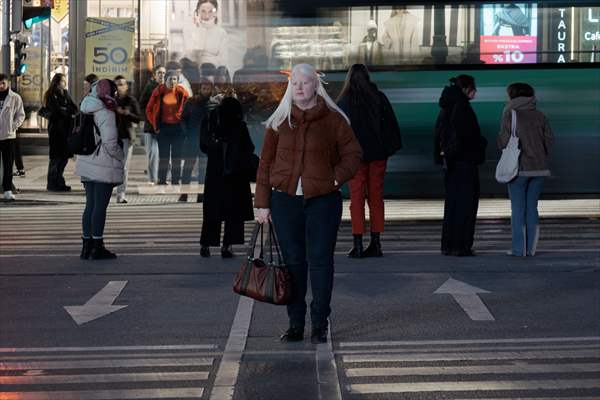 Dünya Nadir Hastalıklar Günü: 'Albino olmak'