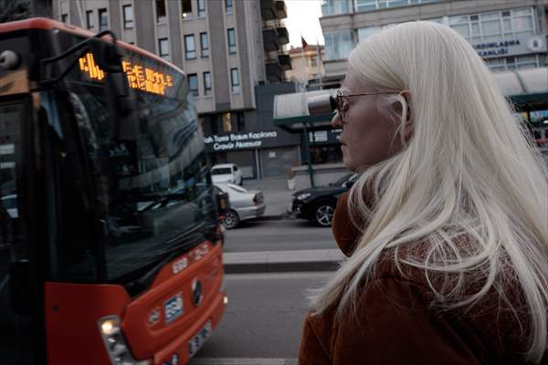 Dünya Nadir Hastalıklar Günü: 'Albino olmak'