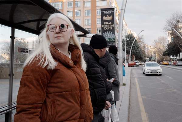 Dünya Nadir Hastalıklar Günü: 'Albino olmak'