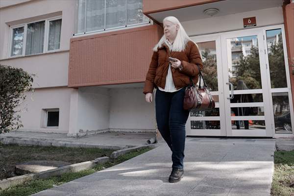 Dünya Nadir Hastalıklar Günü: 'Albino olmak'