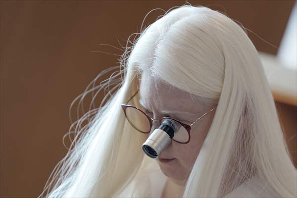 Dünya Nadir Hastalıklar Günü: 'Albino olmak'