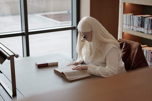 Dünya Nadir Hastalıklar Günü: 'Albino olmak'