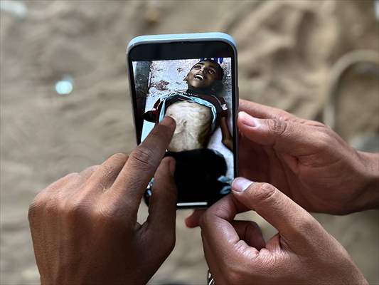 Gazze’de açlıkla mücadele eden AA serbest habercileri insani krizi aktarmayı sürdürüyor