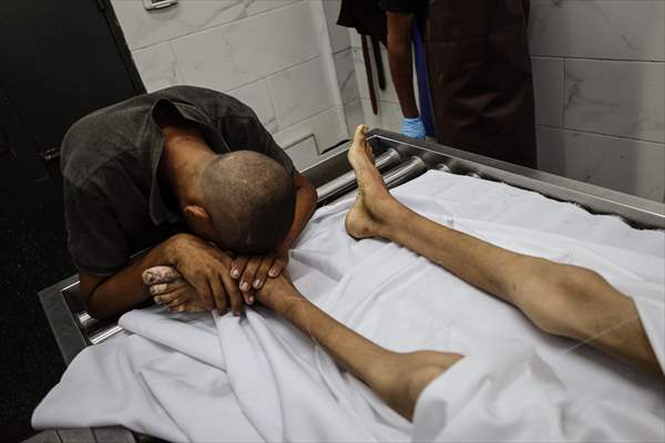 17-year-old boy dies in Gaza due to malnutrition