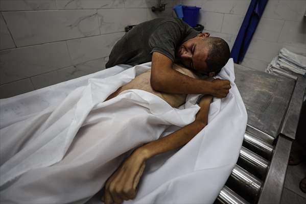 17-year-old boy dies in Gaza due to malnutrition