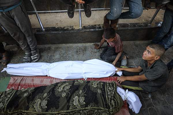 17-year-old boy dies in Gaza due to malnutrition