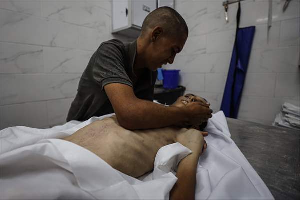 17-year-old boy dies in Gaza due to malnutrition