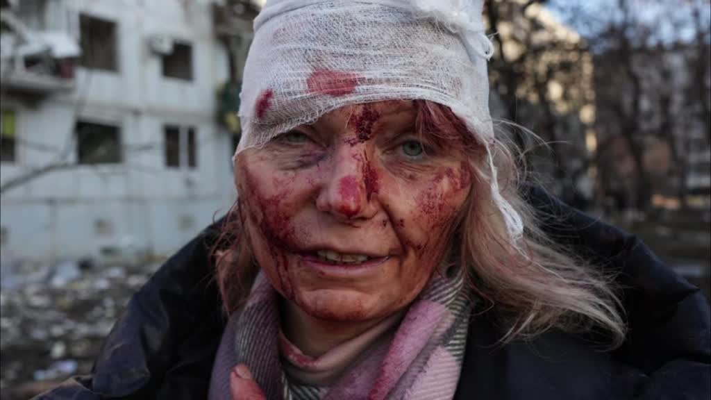 CHUHUİV - Rusya'nın Ukrayna'ya askeri müdahalesinde ölen ve yaralanan siviller oldu