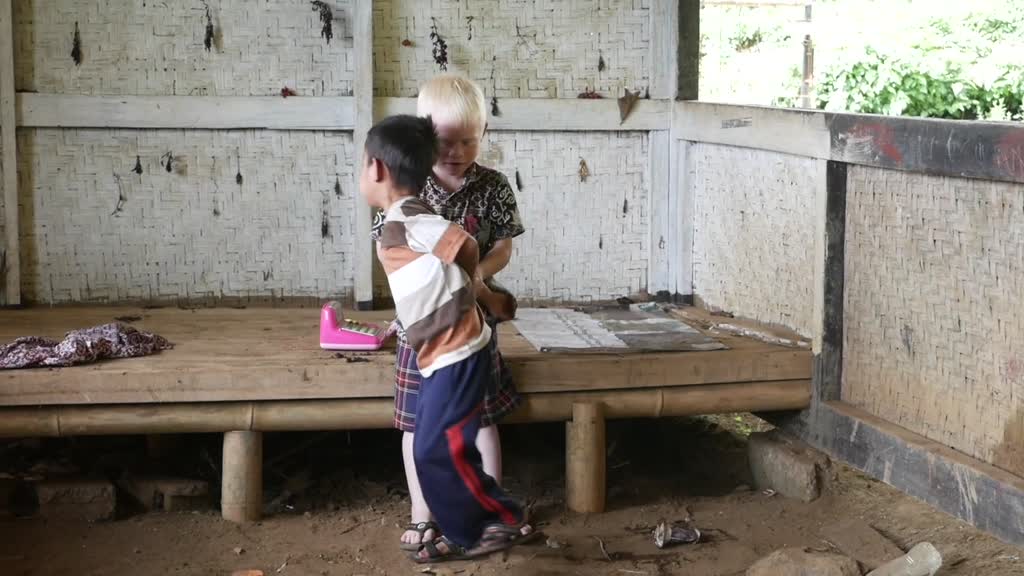Int'l Albinism Awareness Day: Albino kids playing in Indonesian village