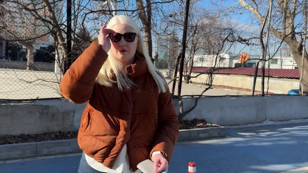 ANKARA - Dünya Nadir Hastalıklar Günü: 'Albino olmak'