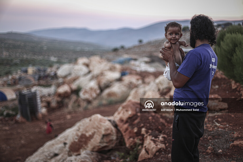 Congenital amputee child of Syrian family