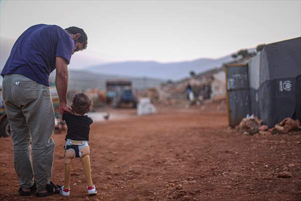 Congenital amputee child of Syrian family returns to hometown with prosthesis legs